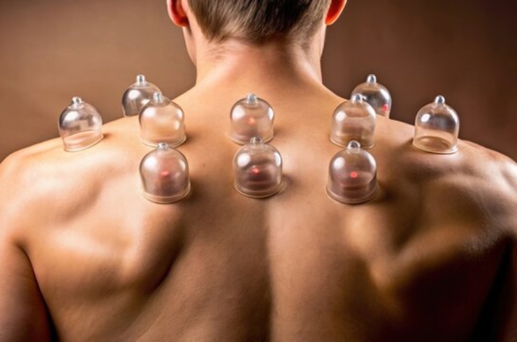 Gym cupping for muscle recovery------14